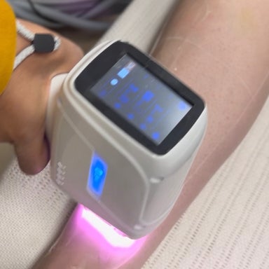 Full Arms Laser hair removal