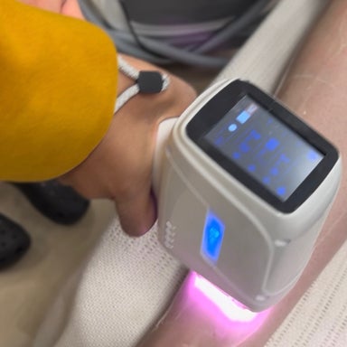 Half Arms Laser hair removal