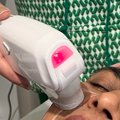 HIFU Tummy Tightening